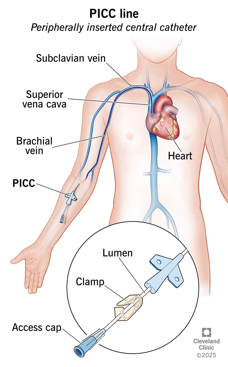 Educational Resources Preventing Bloodstream Infections A Digital Educational Resources Preventing Bloodstream Infections A Digital